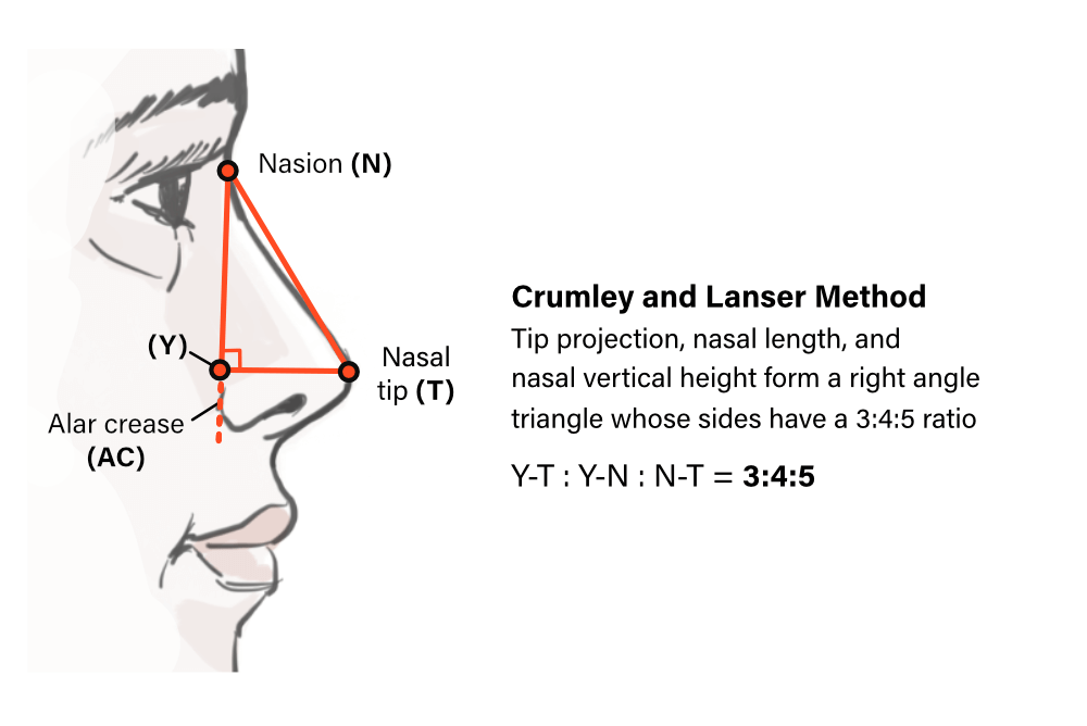 Crumley and Lanser Method